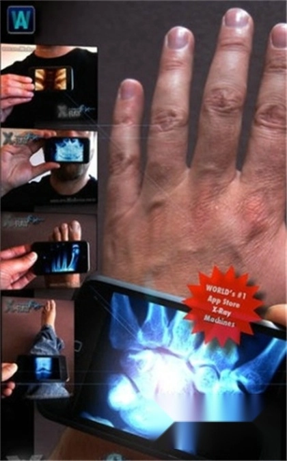 手机骨骼扫描仪软件图2