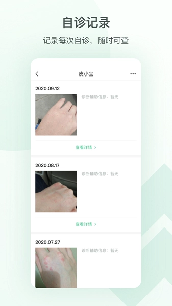 皮小宝(皮肤管理)(2)