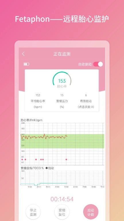 Fetaphon Home胎心监测图2