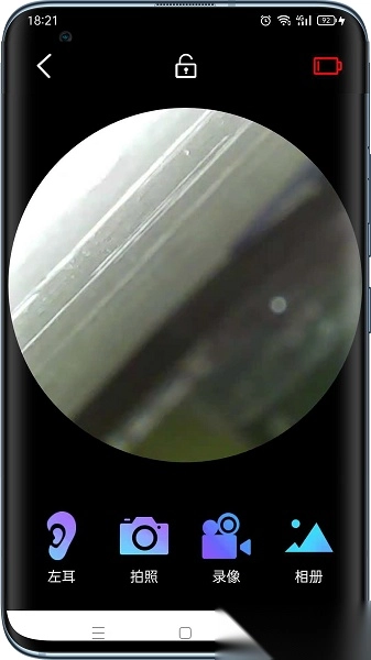 可视采耳仪手机版图3