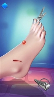 脚部护理模拟图2