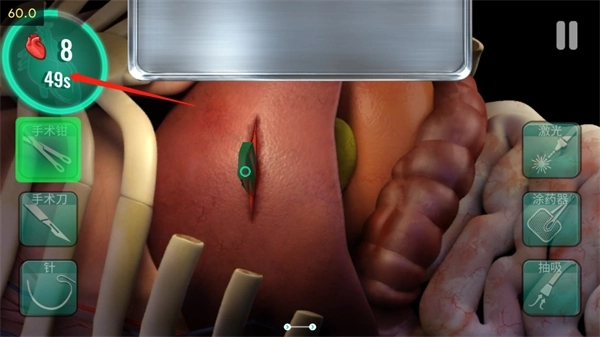 医院手术时间(6)