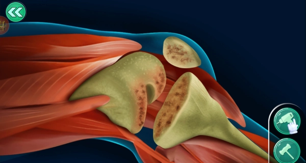 外科手术模拟手机版(1)