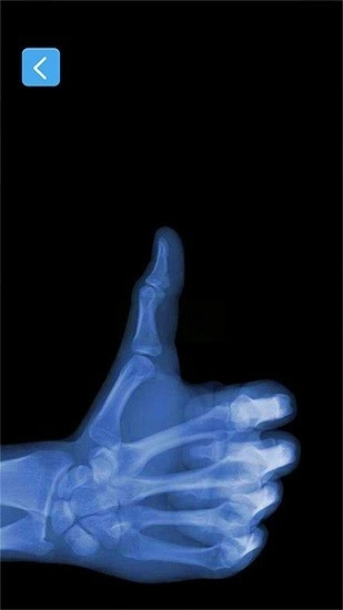 X射线模拟器安卓版