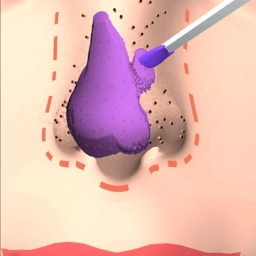 挤黑头大师手机版