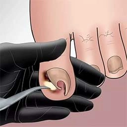 沉浸式减压高手