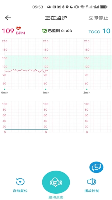 胎心监护app官方版(4)