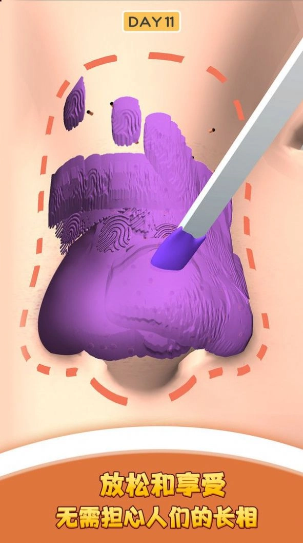 我爱挤黑头游戏最新版图4