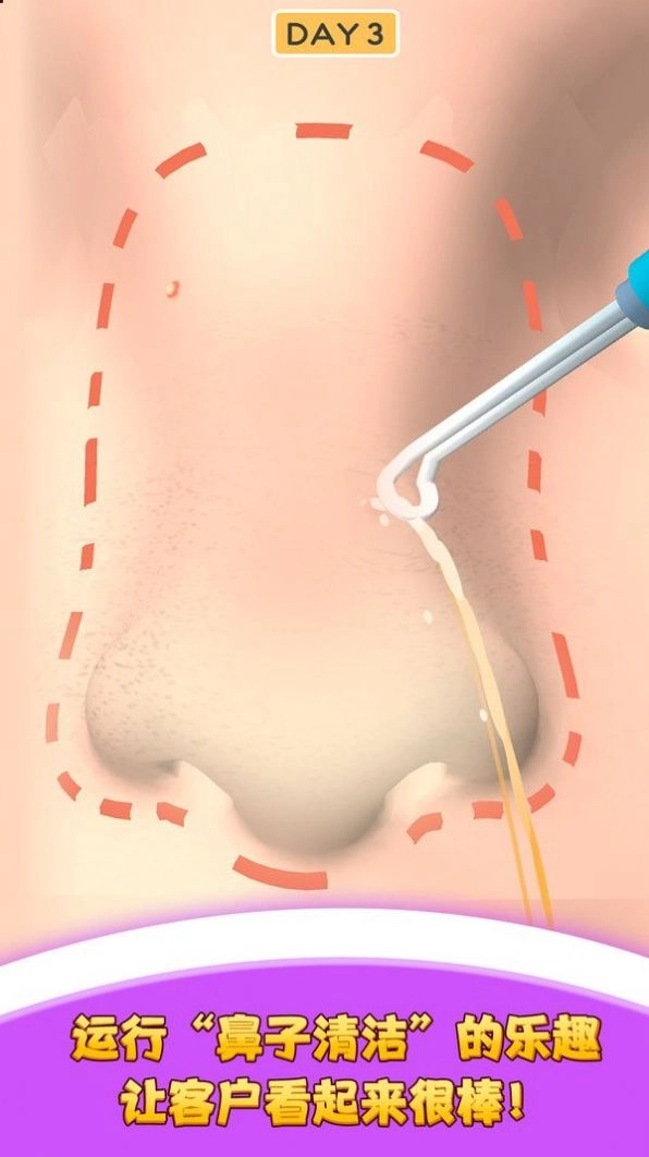 我爱挤黑头游戏最新版图3