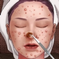 挤痘大师游戏安装