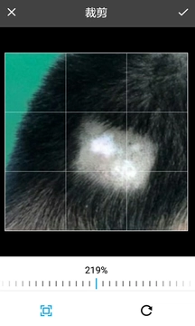 皮肤病拍照自测(3)