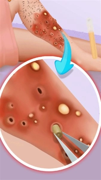 沉浸式牙齿清洁(3)