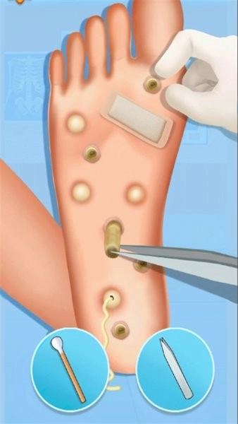 沉浸式牙齿清洁(4)