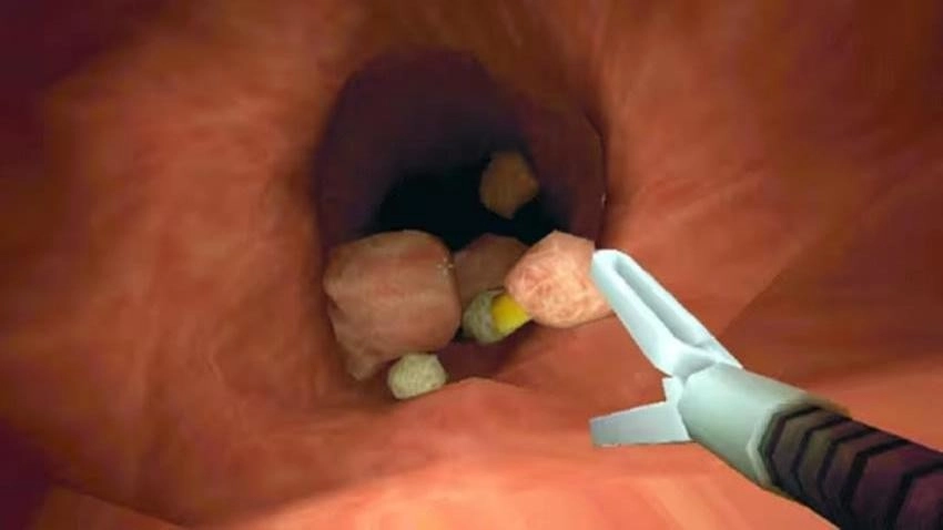 真实肠胃医生游戏图1