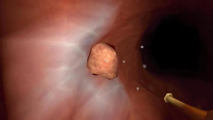 真实肠胃医生游戏图3