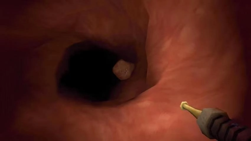 真实肠胃医生游戏图2