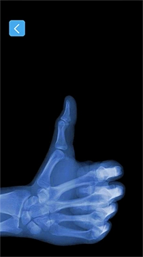 X射线模拟器图1