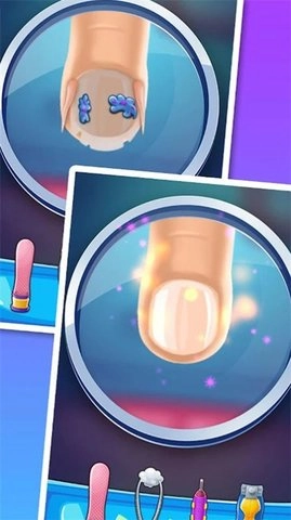 小镇修脚医生图1