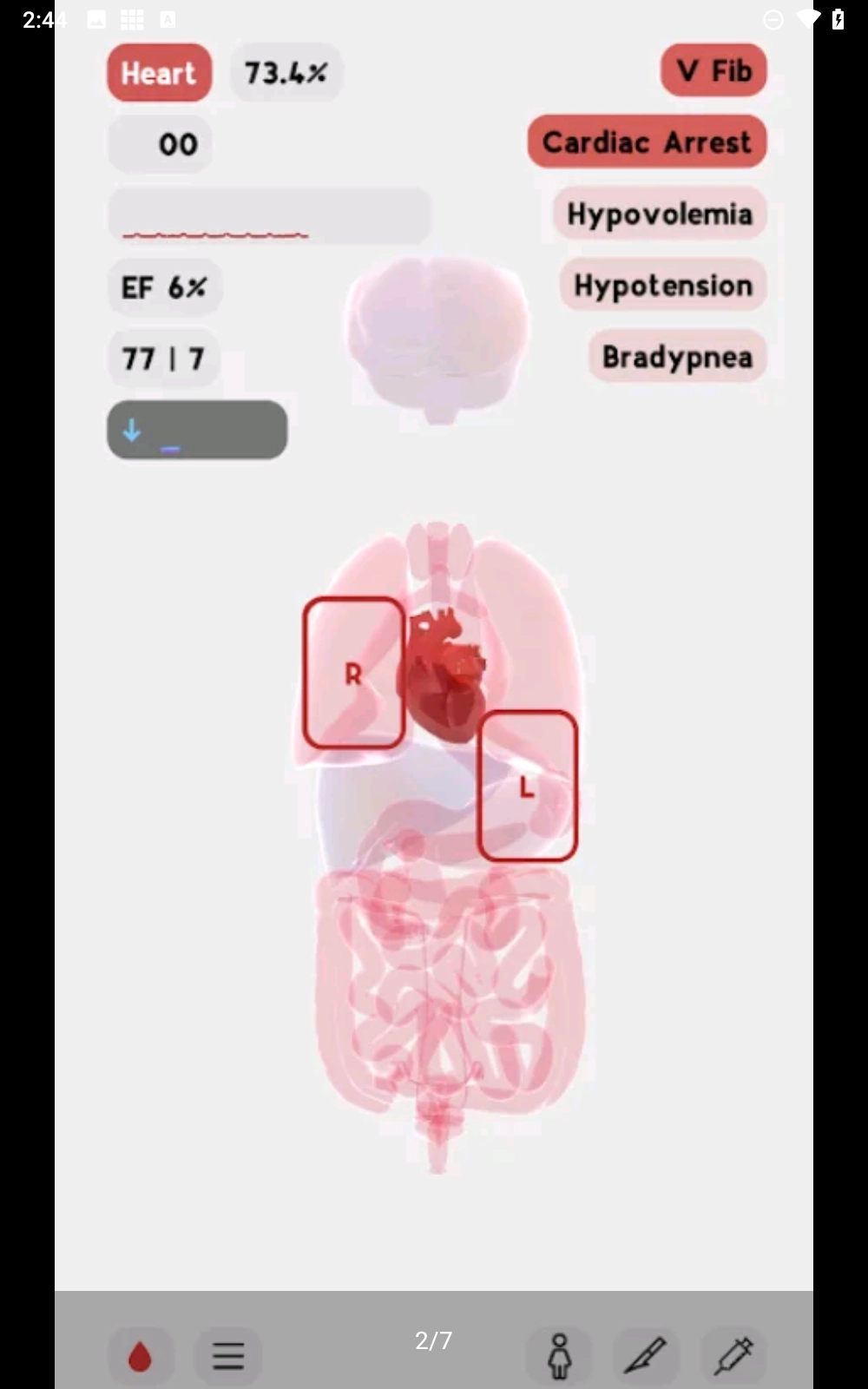 生命人体模拟器(1)