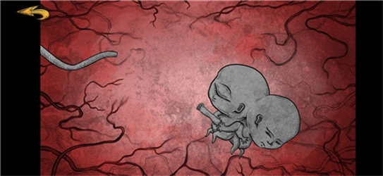 人生画廊汉化版