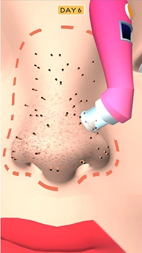 鼻子的美容师图2