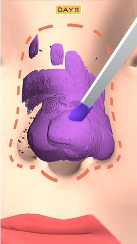 鼻子的美容师图1