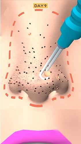 鼻子的美容师图3