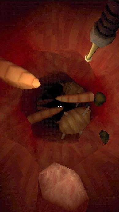 大肠复仇之旅(1)