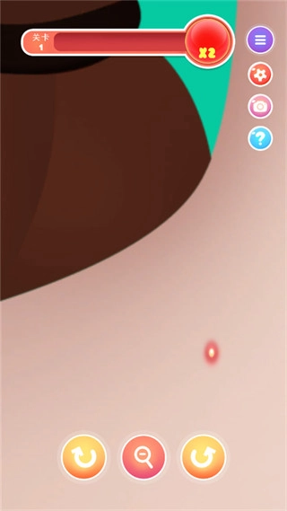 挤痘痘达人2026版图1