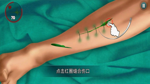 外科医生挑战图2